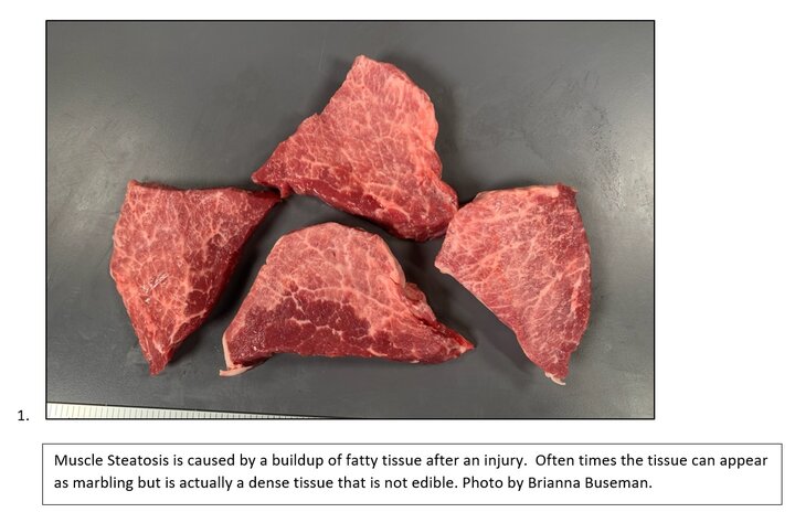 Muscle steatosis